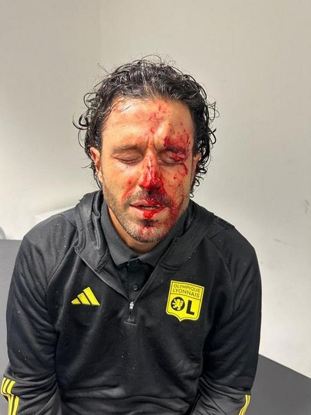 多大仇！马赛球迷袭击里昂大巴，意大利传奇头部出血，比赛改期(大巴足球)